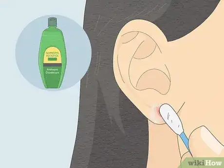 Imagen titulada Clean Your Ear Piercing Step 12