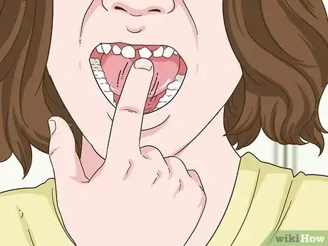 Imagen titulada Painlessly Pull Out a Loose Baby Tooth Step 5