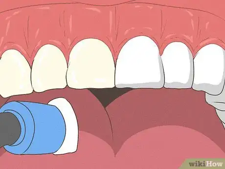 Imagen titulada Fix Nicotine Stained Teeth Step 9