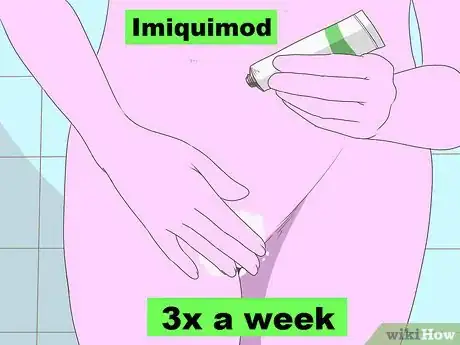 Imagen titulada Get Rid of Genital Warts Step 5