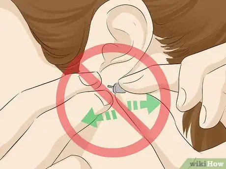 Imagen titulada Keep a Piercing from Rejecting Step 4.jpeg