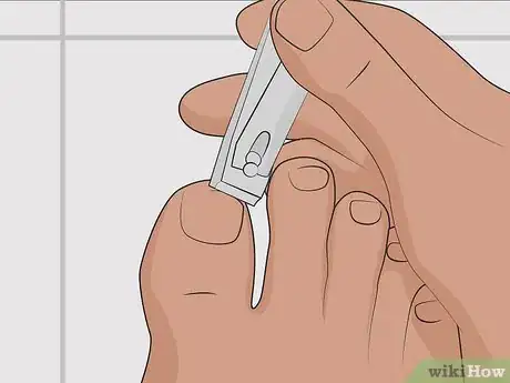 Imagen titulada Heal a Bruised Toenail Quickly Step 16