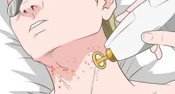 deshacerse del acné en el cuello