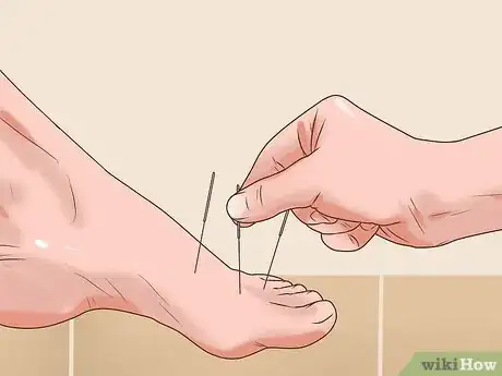 Imagen titulada Treat Bunions Naturally Step 9