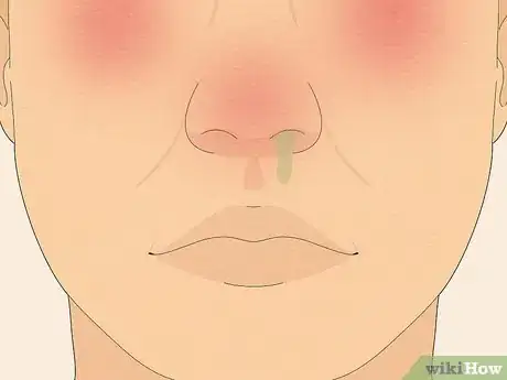 Imagen titulada Make Saline Nasal Spray Step 16