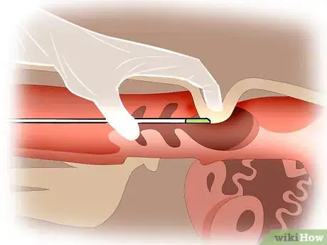 Imagen titulada Artificially Inseminate Cows and Heifers Step 20