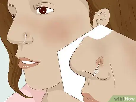 Imagen titulada Keep a Piercing from Rejecting Step 9.jpeg