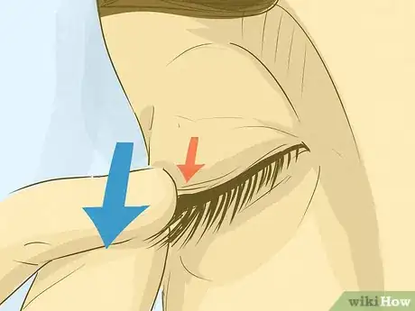 Imagen titulada Get an Eyelash Out of Your Eye Step 10