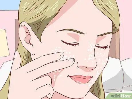 Imagen titulada Get Rid of Acne Without Using Medication Step 14