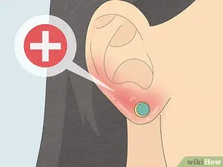 Imagen titulada Clean Your Ear Piercing Step 14