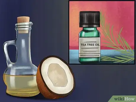 Imagen titulada Treat a Yeast Infection on Your Skin Step 7