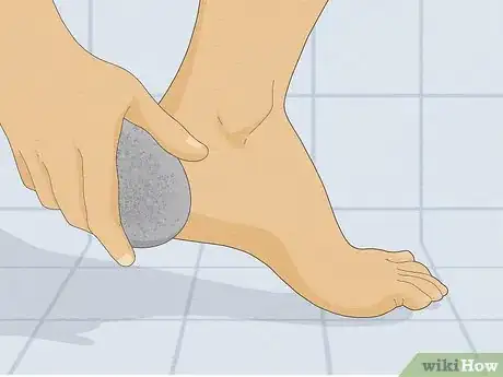 Imagen titulada Get Soft Feet Step 1