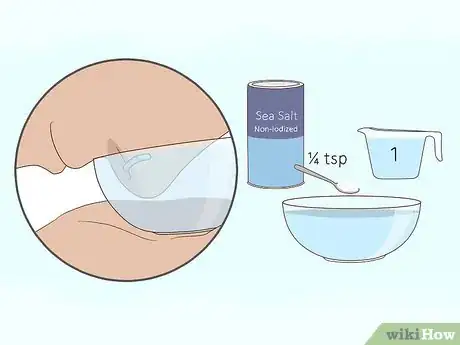 Imagen titulada Heal a Nose Ring and Take Care of Infections Step 4