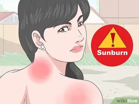 Imagen titulada Protect Your Neck from the Sun Step 11