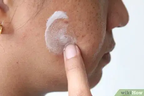 Imagen titulada Apply Toothpaste on Pimples Step 11