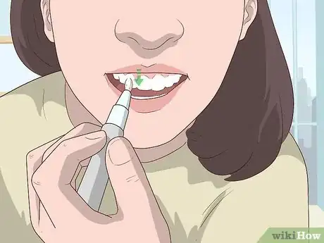 Imagen titulada Use a Whitening Pen Step 5.jpeg