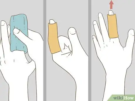 Imagen titulada Determine if a Finger Is Broken Step 8