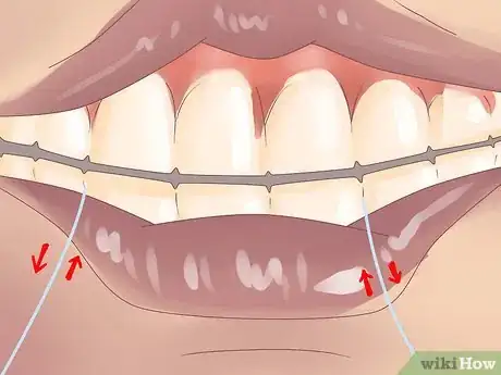 Imagen titulada Stop Bleeding Gums, Gingivitis, Periodontitis Step 5