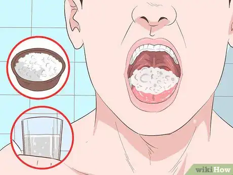 Imagen titulada Remove Tonsil Stones (Tonsilloliths) Step 13