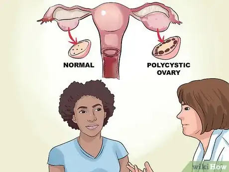 Imagen titulada Recognize the Symptoms of Polycystic Ovary Syndrome Step 5