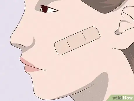 Imagen titulada Heal Scratch Marks on Your Face Step 6