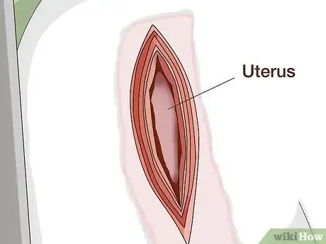 Imagen titulada Perform a Caesarean Section on a Cow or Heifer Step 7