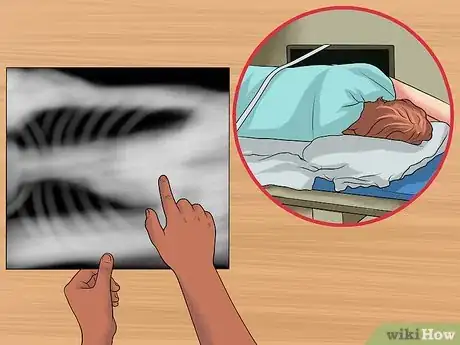 Imagen titulada Read a Chest X Ray Step 10