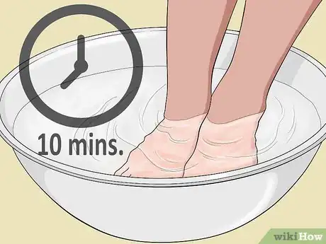 Imagen titulada Tell if an Ingrown Toenail Is Infected Step 5