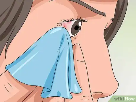 Imagen titulada Get Rid of Pink Eye Fast Step 4