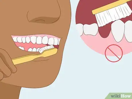 Imagen titulada Prevent Dry Socket After a Tooth Extraction Step 4