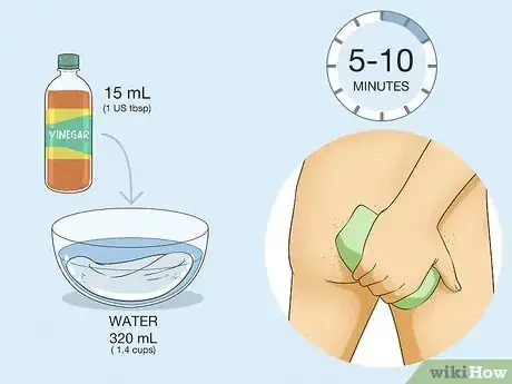 Imagen titulada Get Rid of Acne on the Buttocks Step 9