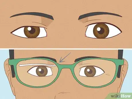 Imagen titulada Fix Asymmetrical Eyes Step 1