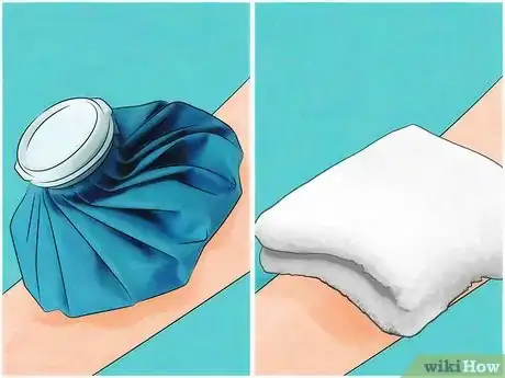 Imagen titulada Apply a Cold Compress Step 5