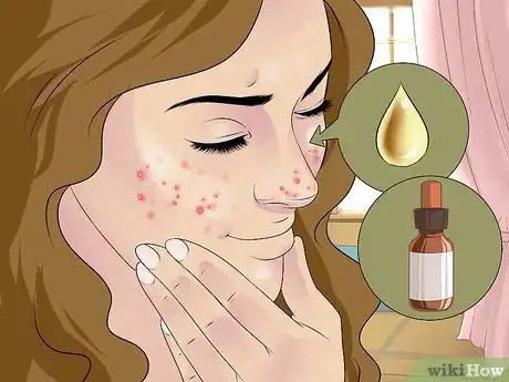 Imagen titulada Dry Out a Pimple Step 19