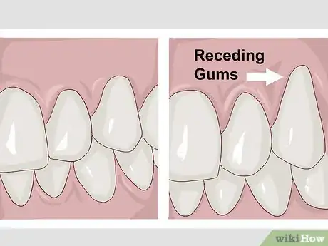 Imagen titulada Stimulate Gum Growth Step 10