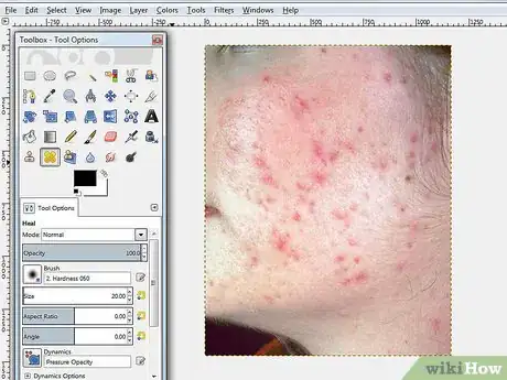 Imagen titulada Remove Facial Blemishes on GIMP Step 1