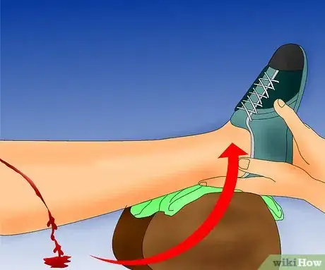 Imagen titulada Stop Bleeding Step 7