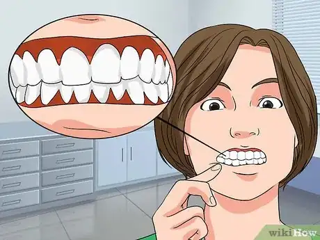 Imagen titulada Strengthen Teeth and Gums Step 12