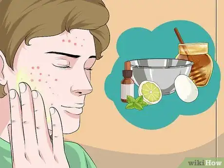 Imagen titulada Dry Out a Pimple Step 10