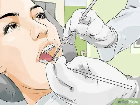 Imagen titulada Treat a Tooth Abscess Step 7