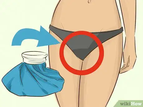 Imagen titulada Soothe a Sore Vagina Step 1