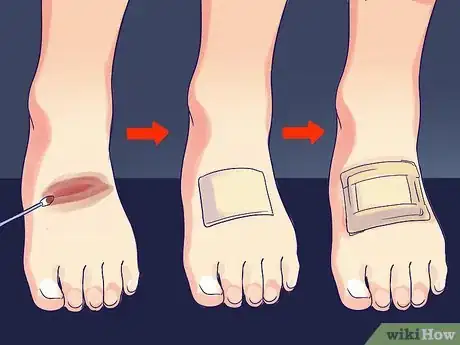 Imagen titulada Change a Wound Dressing Step 6