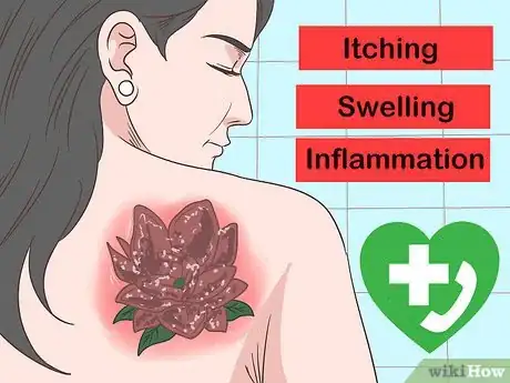 Imagen titulada Treat an Infected Tattoo Step 10