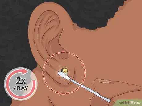 Imagen titulada Put Your Earring Back when It Won't Go in Step 10