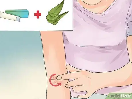 Imagen titulada Treat Eczema Naturally Step 9