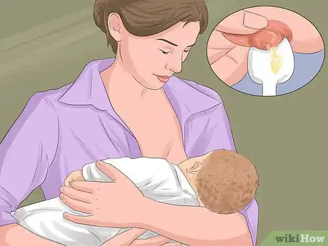 Imagen titulada Prevent Jaundice in Newborns Step 3