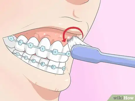 Imagen titulada Make Your Braces Hurt Less Step 5