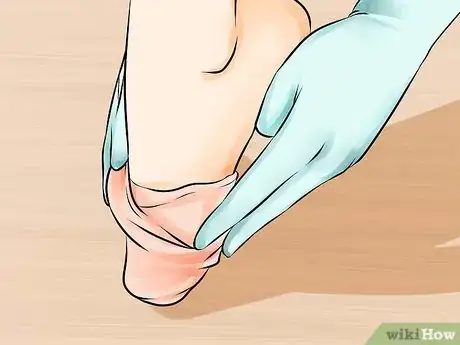 Imagen titulada Put on Compression Stockings Step 8