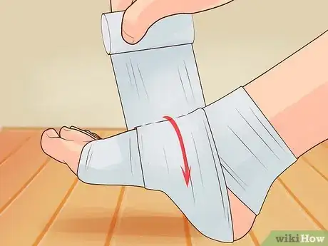 Imagen titulada Wrap an Ankle Step 4