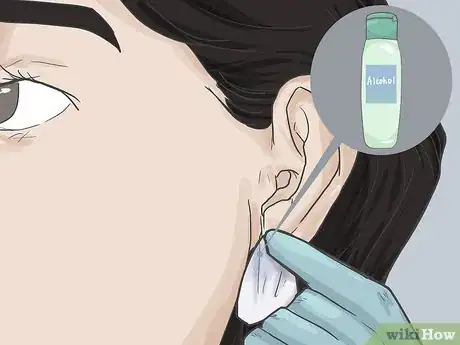 Imagen titulada Pierce Your Ear with a Safety Pin Step 4